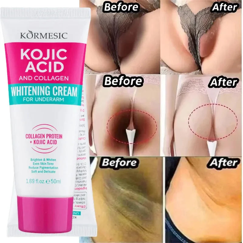 Whitening Cream For Private Parts