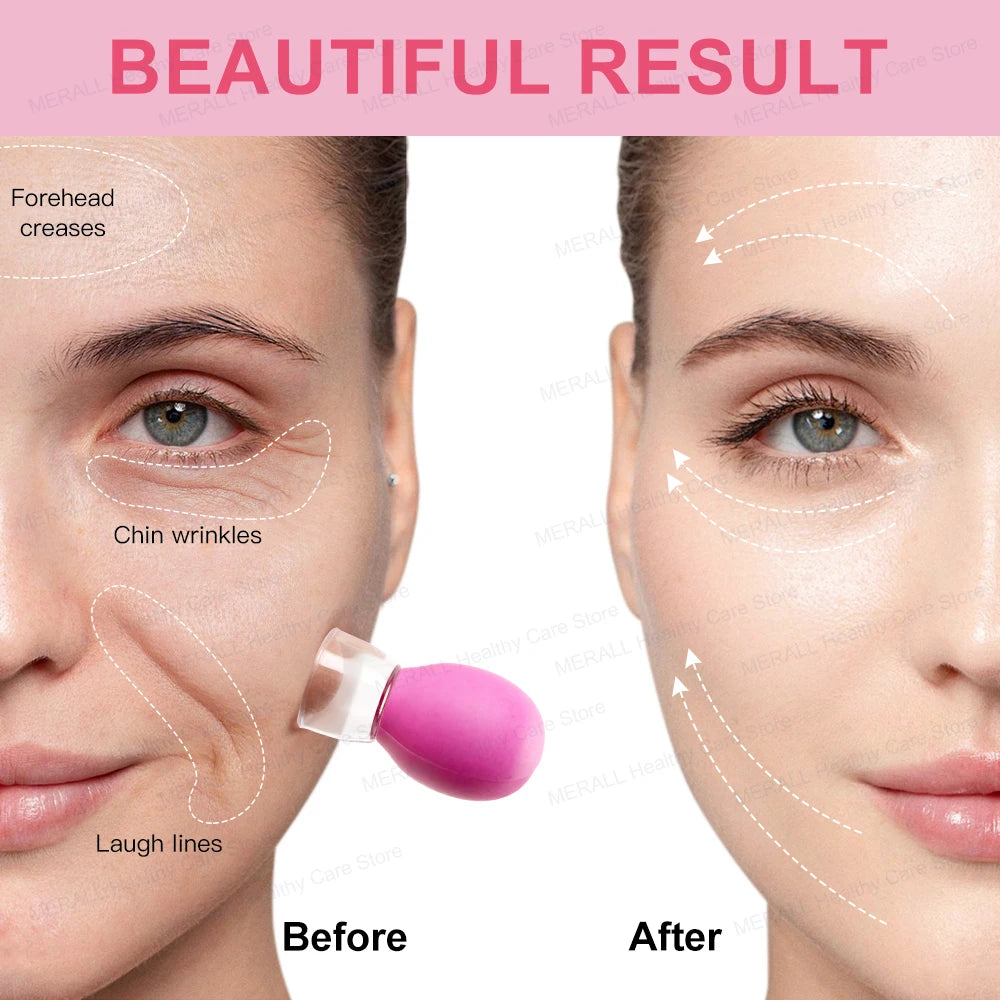 Silicone Cupping Vacuum Massage