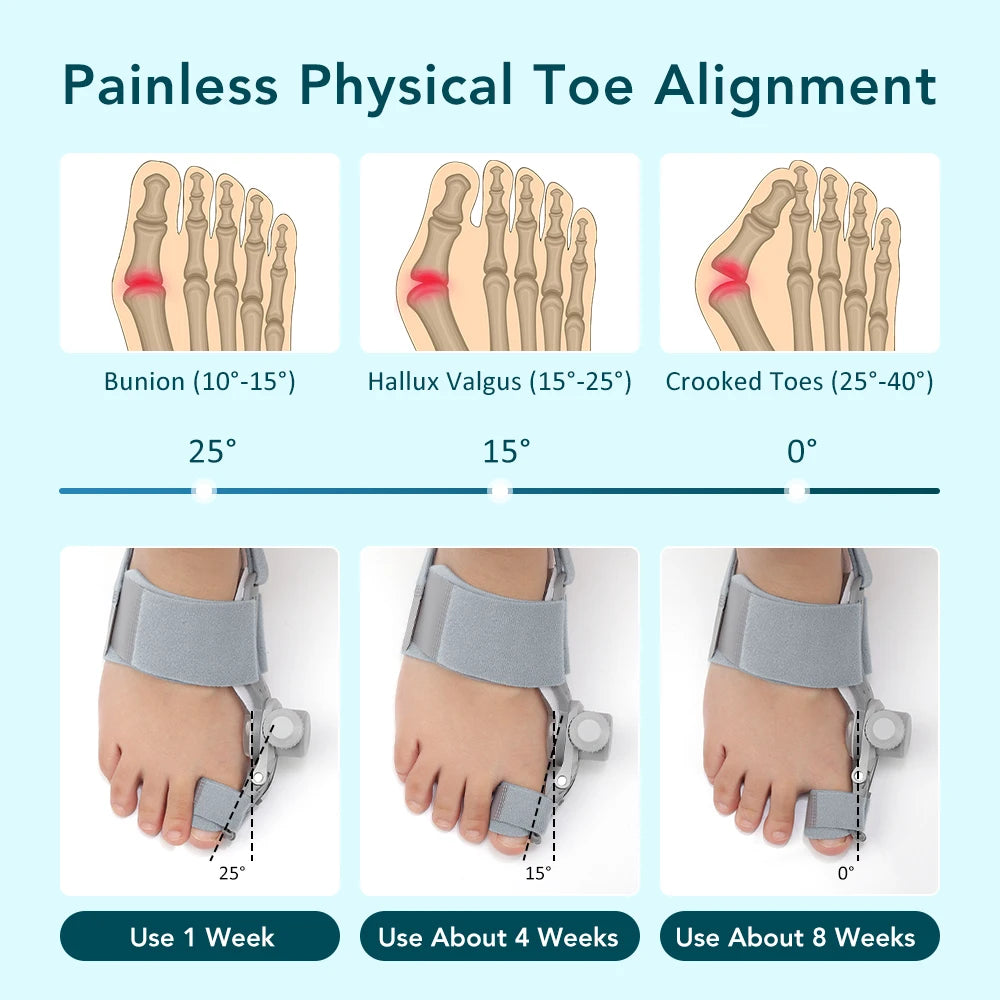 Bunion Corrector for Hallux Valgus