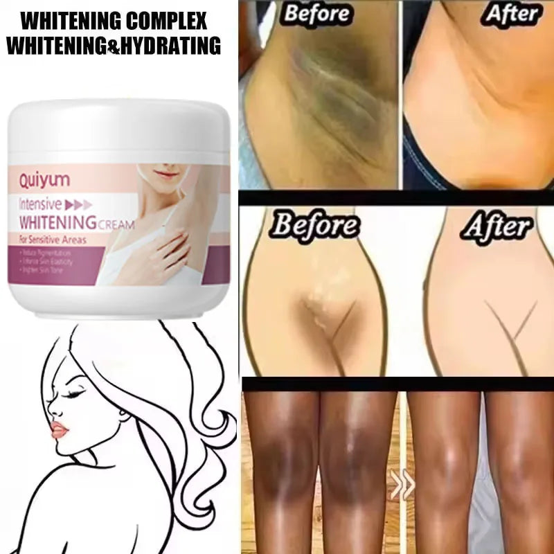 Whitening Cream For Dark Skin