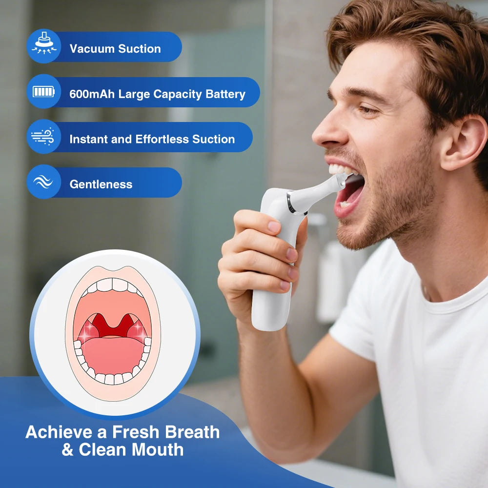 Tonsil Stone Remover Kit