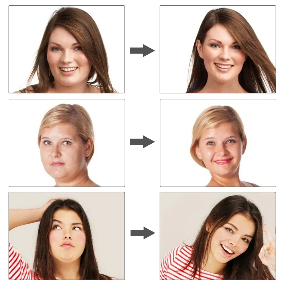 V-Line Lift Up Face Lifting Device