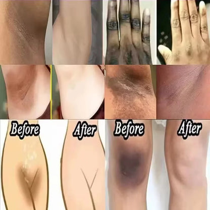 Whitening Cream For Dark Skin