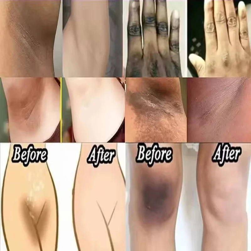 Whitening Cream For Dark Skin