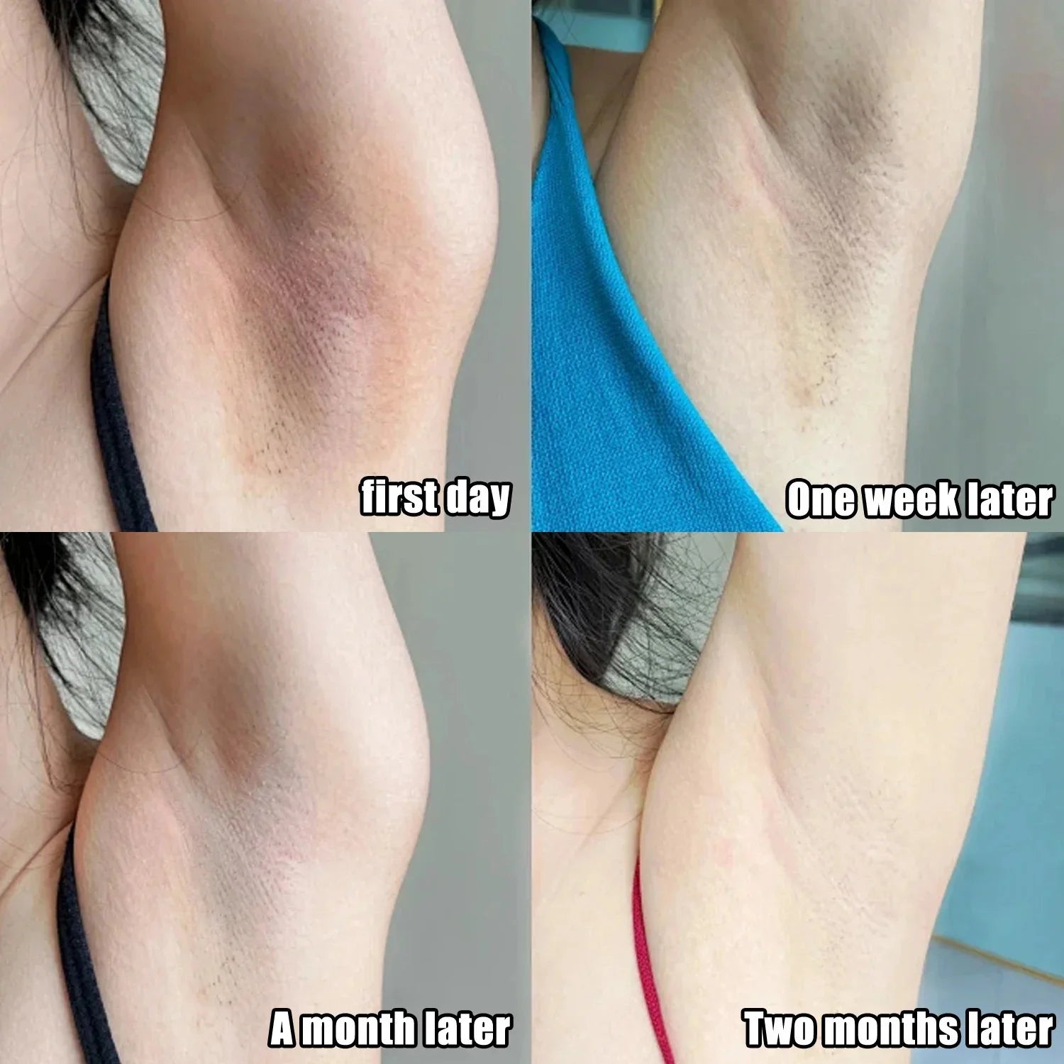 Whitening Cream For Private Parts