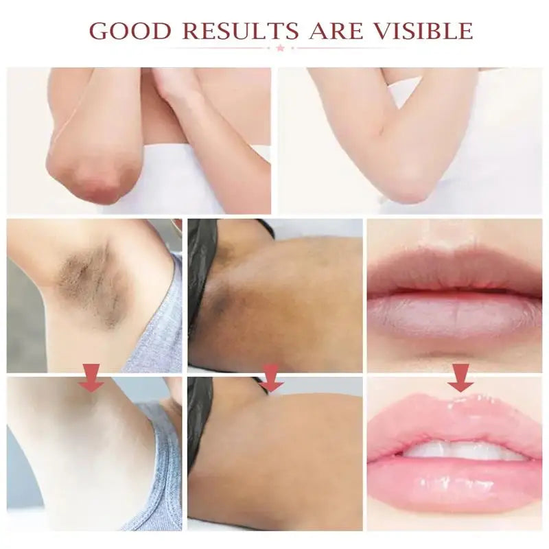 Whitening Cream For Dark Skin