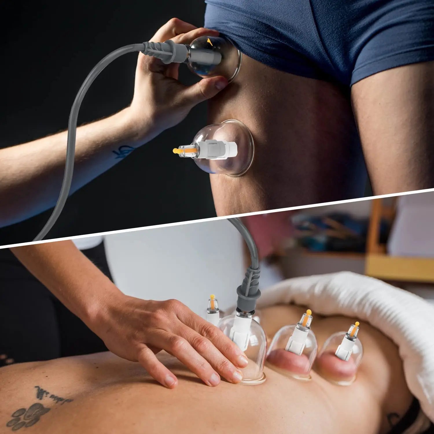 Body Cup Set For Cupping Therapy Massage