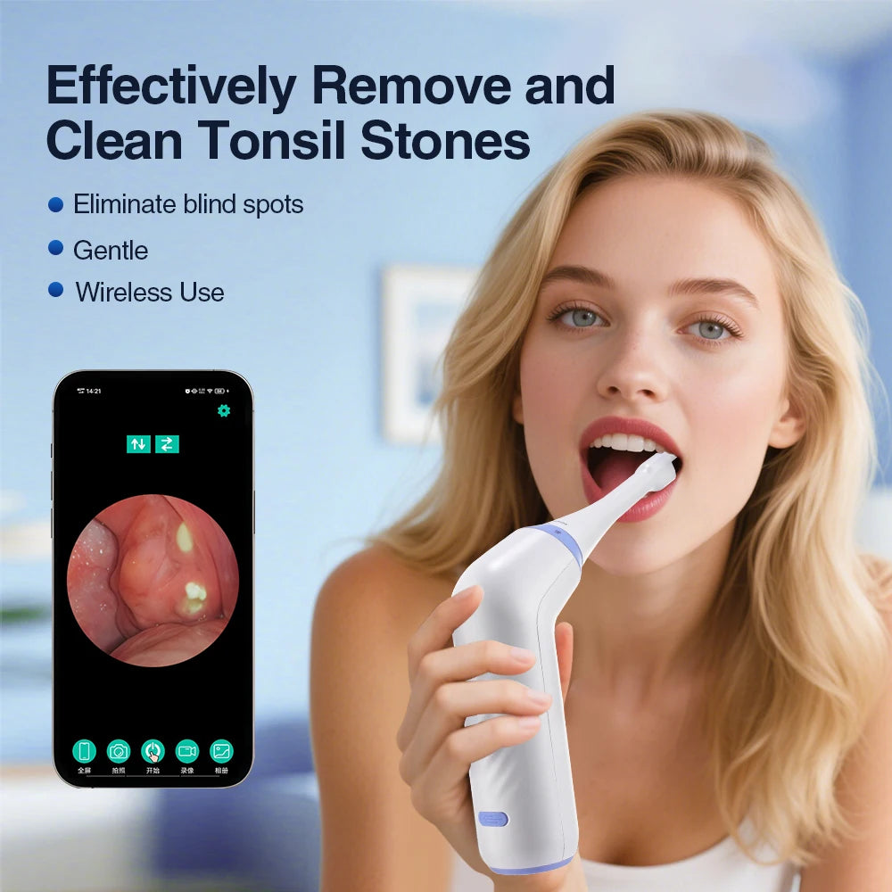 Tonsil Stone Remover Kit
