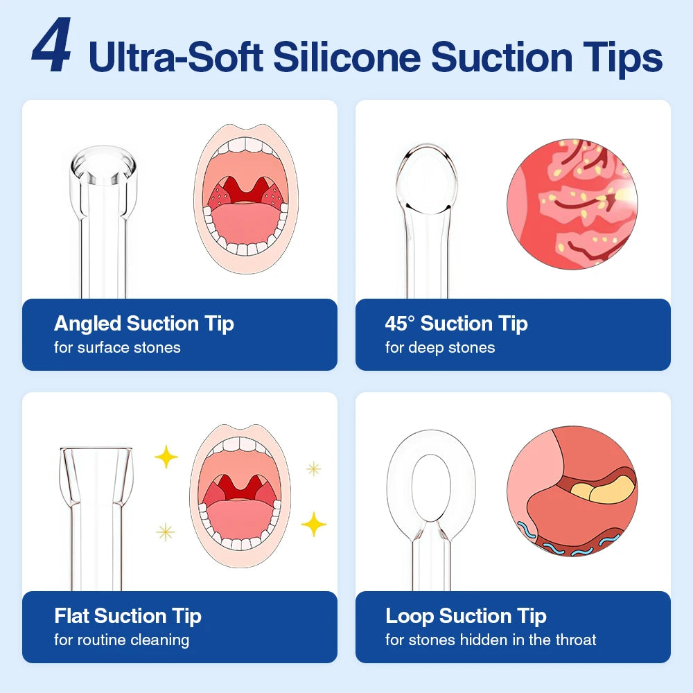 Tonsil Stone Remover Kit